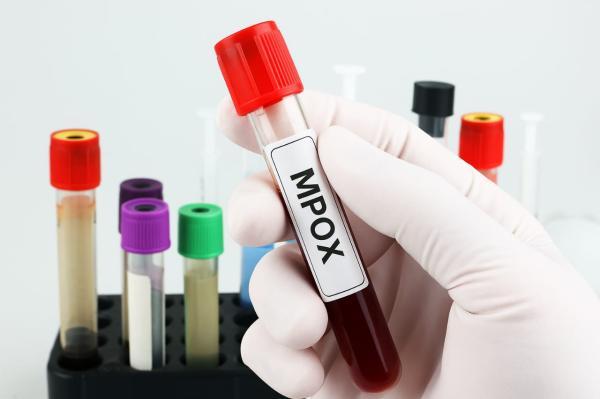 Amapá Não Registra Casos Confirmados de Mpox: Boatos São Desmentidos pelas Autoridades de Saúde